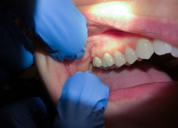 Best Emergency TMJ Treatment in Maumelle, AR