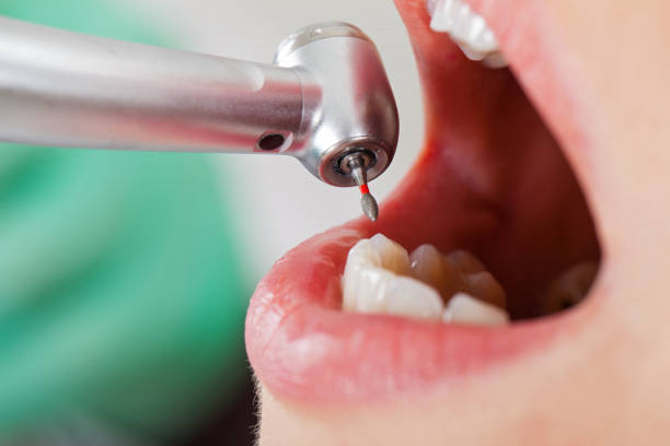 Best Same-Day Emergency Dental Services in Maumelle, AR